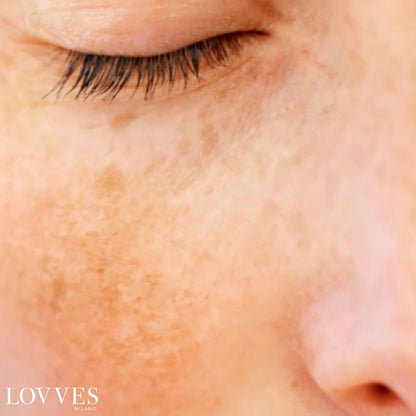 Sérum Aclarante Manchas Faciales Despigmentante