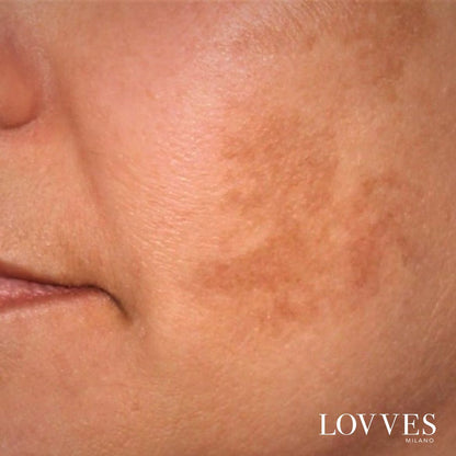 Sérum Aclarante Manchas Faciales Despigmentante