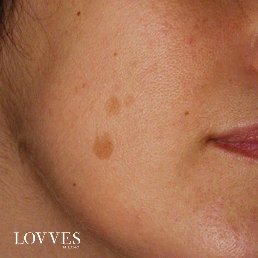 Sérum Aclarante Manchas Faciales Despigmentante