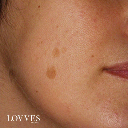 Sérum Aclarante Manchas Faciales Despigmentante