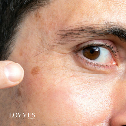 Sérum Aclarante Manchas Faciales Despigmentante